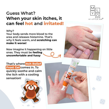 MyLO GWS Itch Relief Frost Gel (15g)